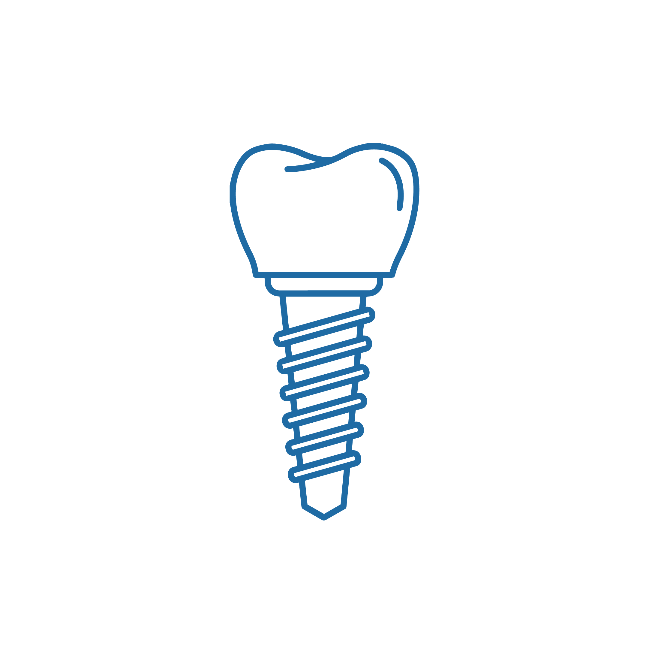 Dental Implant