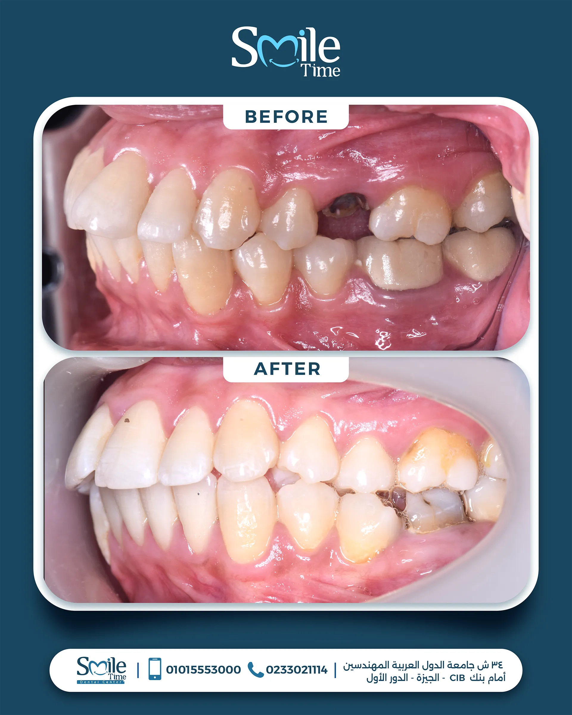 smile-time-before-and-after-1