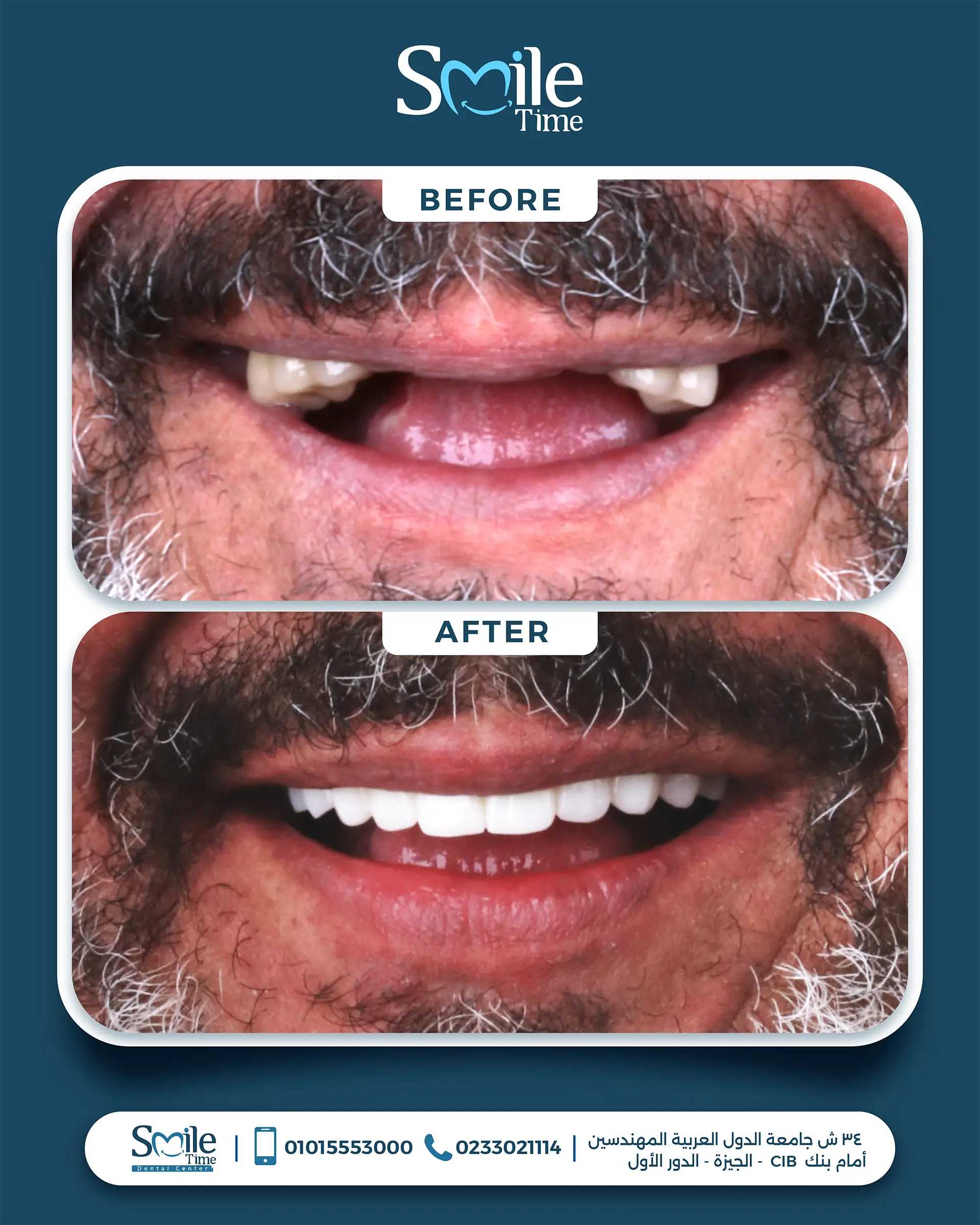 smile-time-before-and-after-10