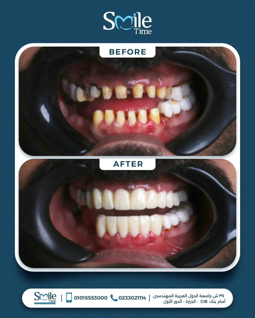smile-time-before-and-after-11