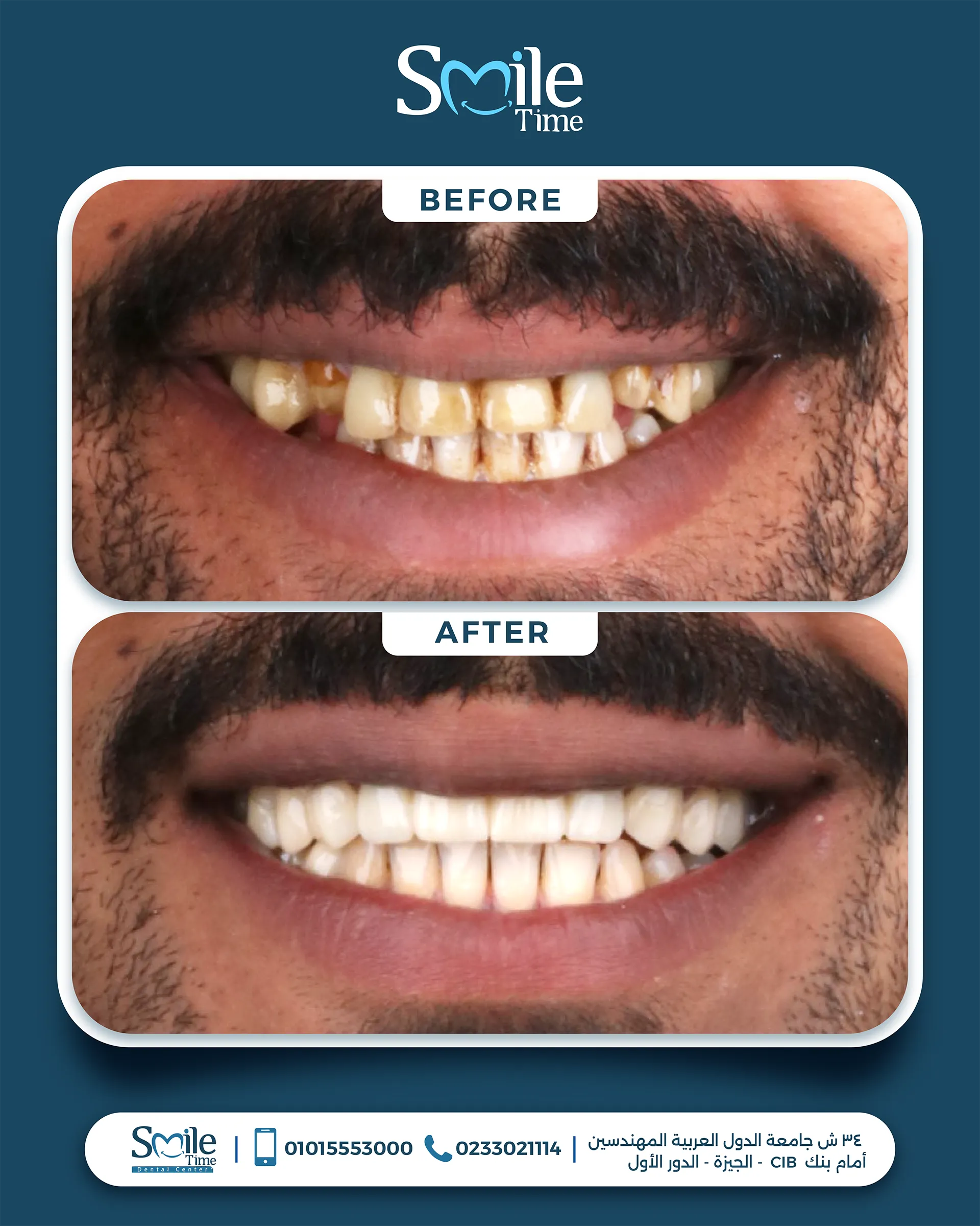 smile-time-before-and-after-12