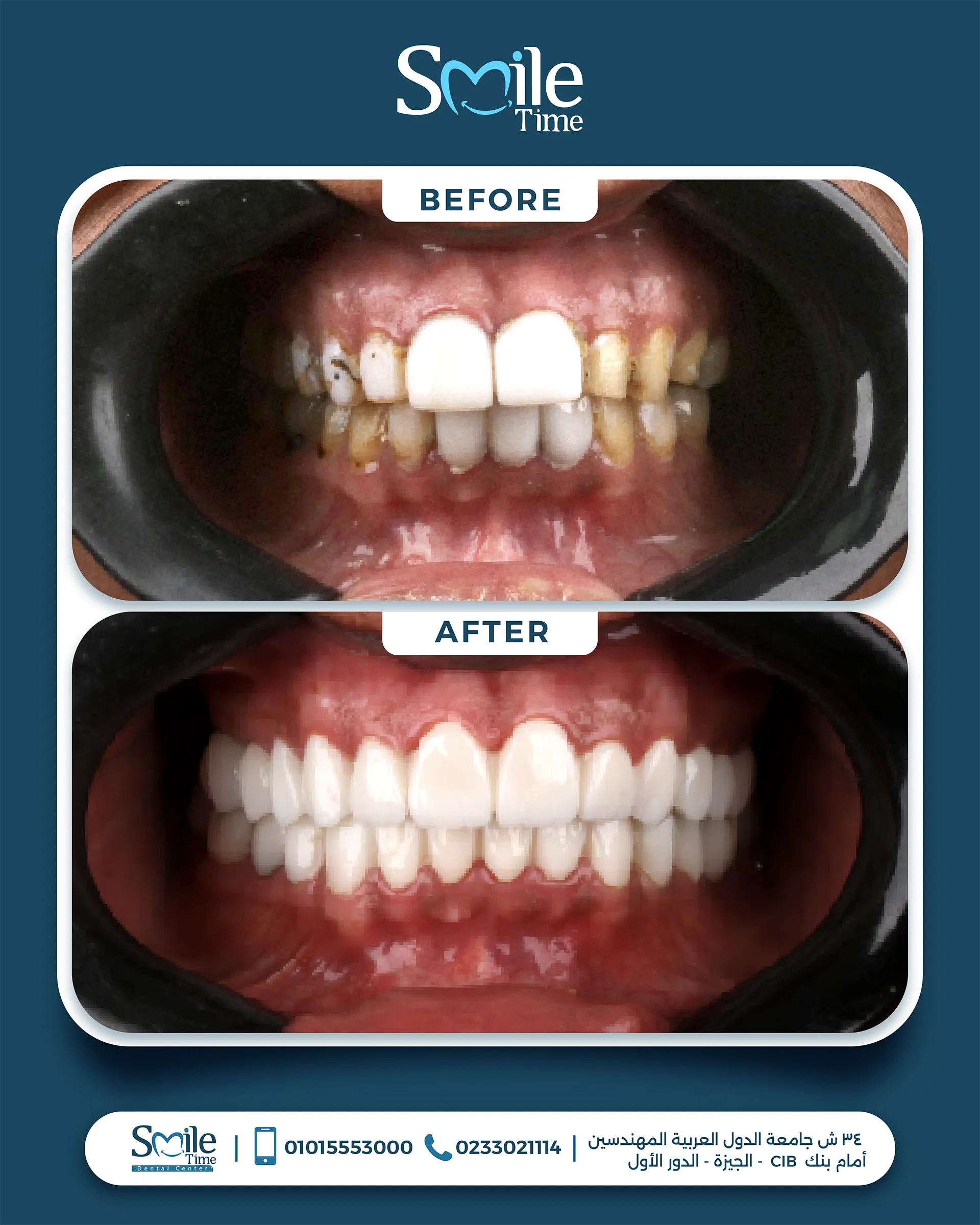 smile-time-before-and-after-13