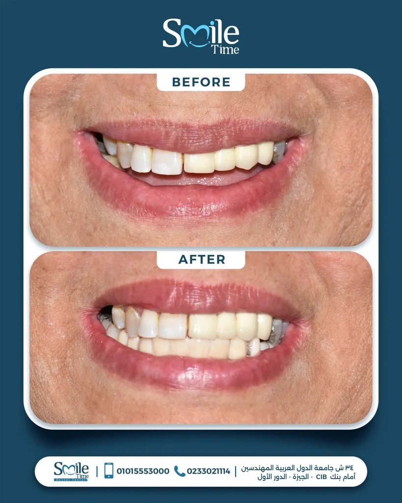 smile-time-before-and-after-14