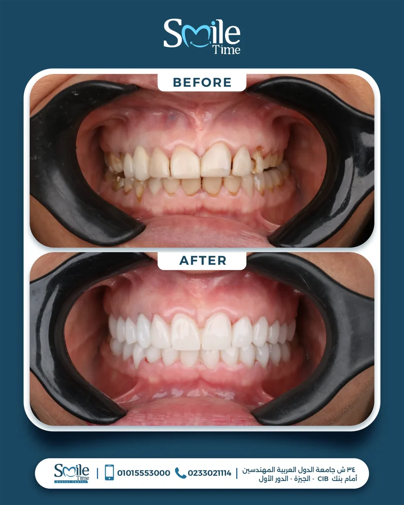 smile-time-before-and-after-15