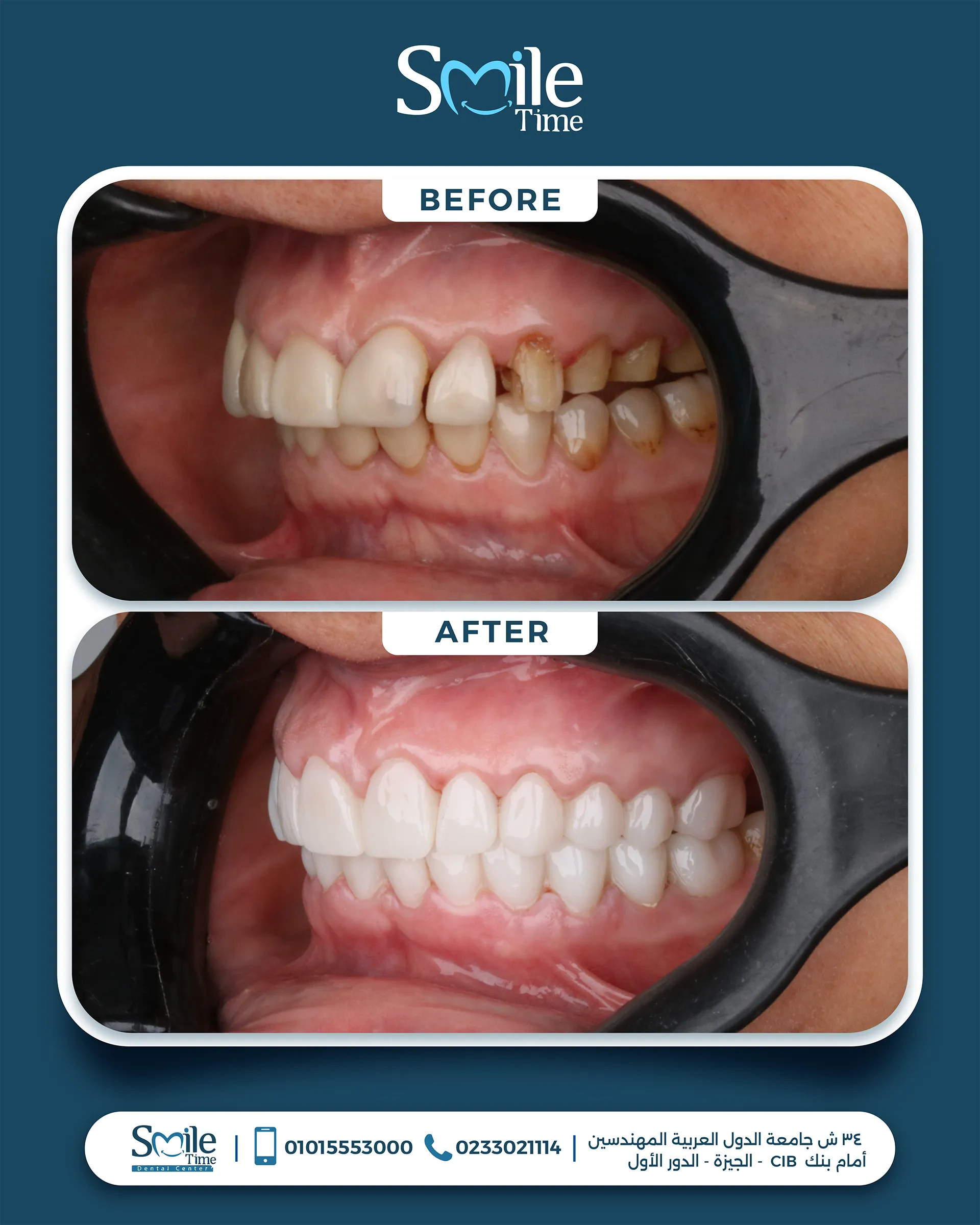 smile-time-before-and-after-16