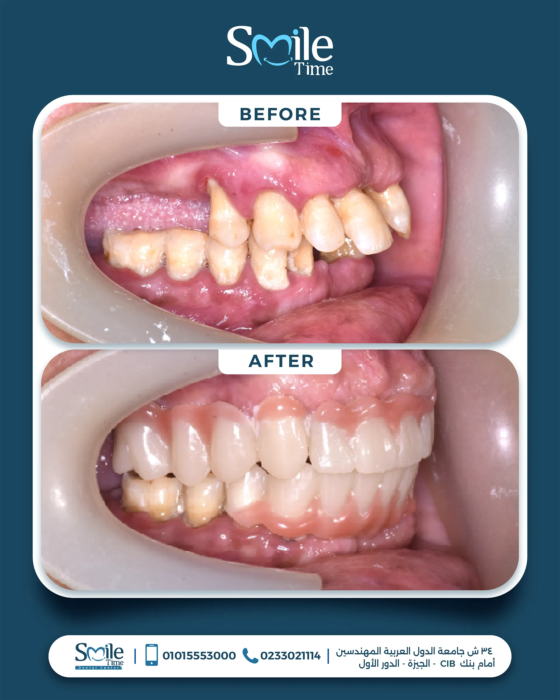 smile-time-before-and-after-17