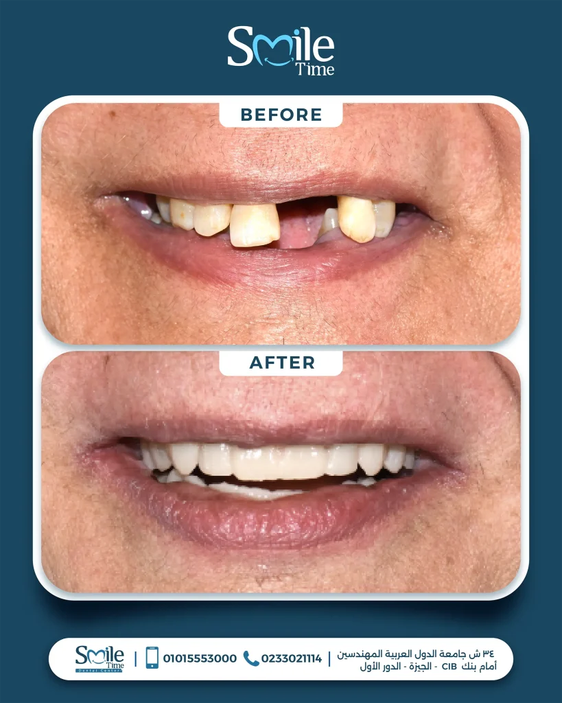 smile-time-before-and-after-18