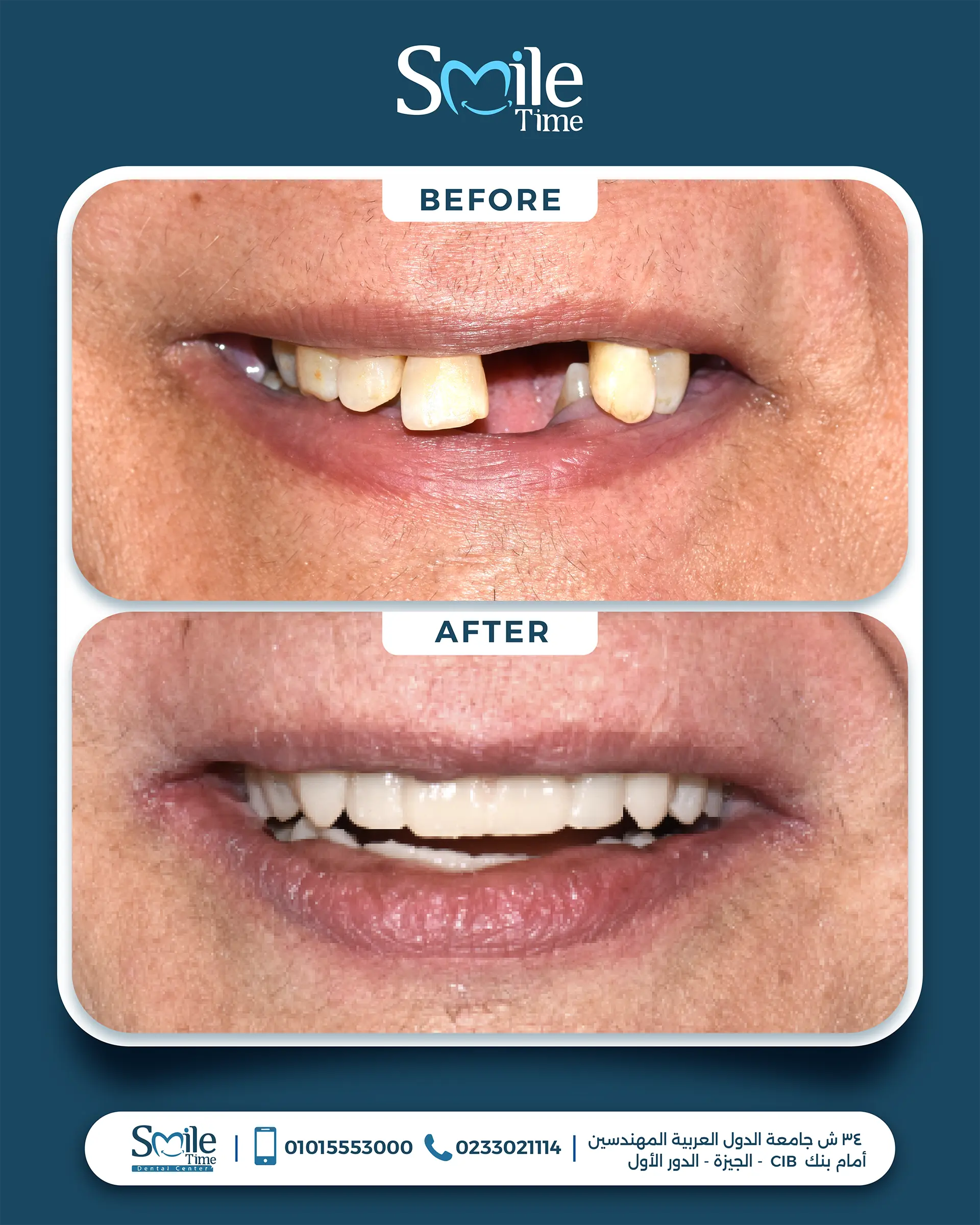 smile-time-before-and-after-18