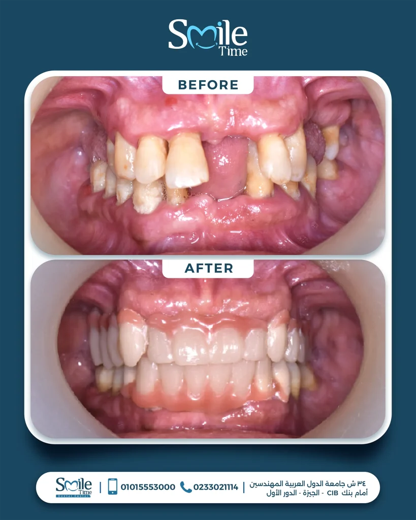 smile-time-before-and-after-19