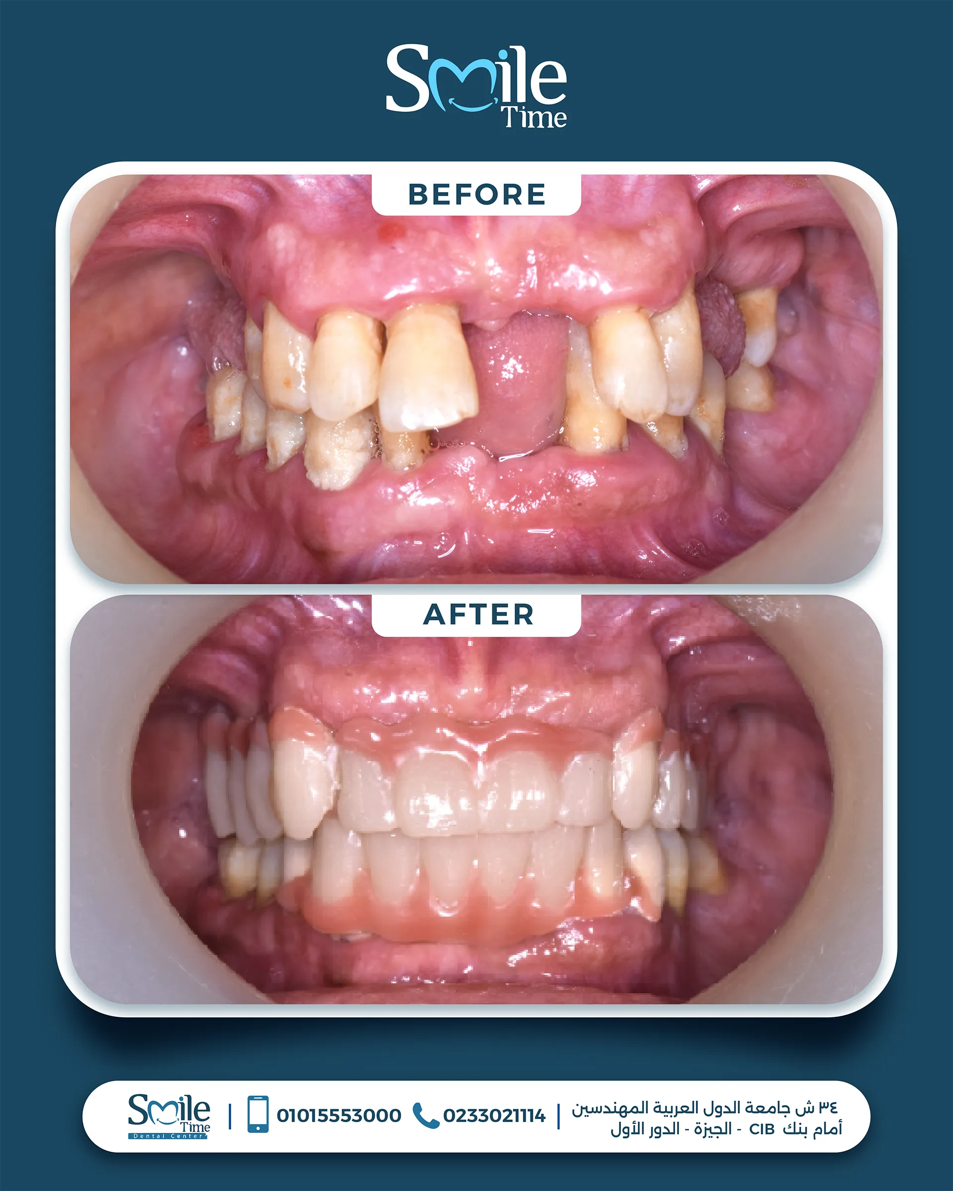 smile-time-before-and-after-19