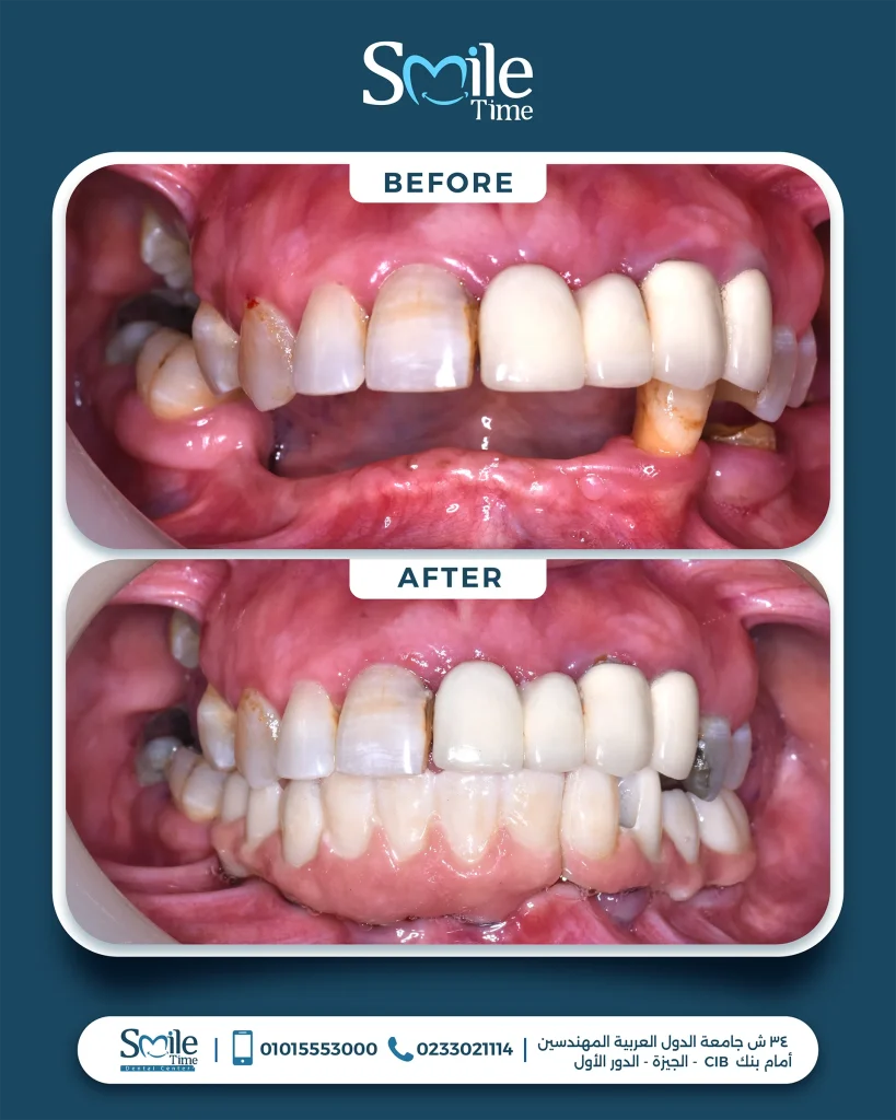 smile-time-before-and-after-20