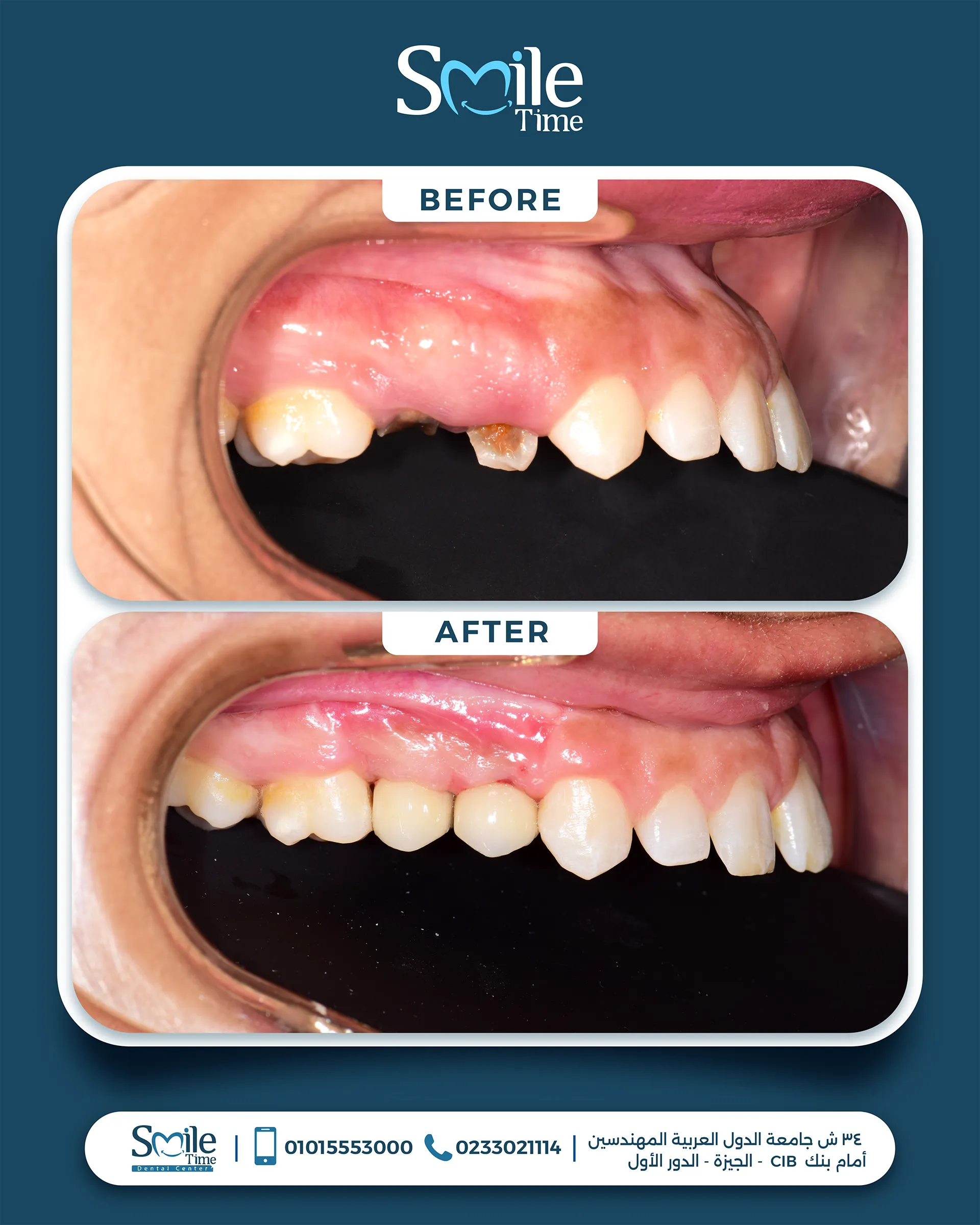 smile-time-before-and-after-4