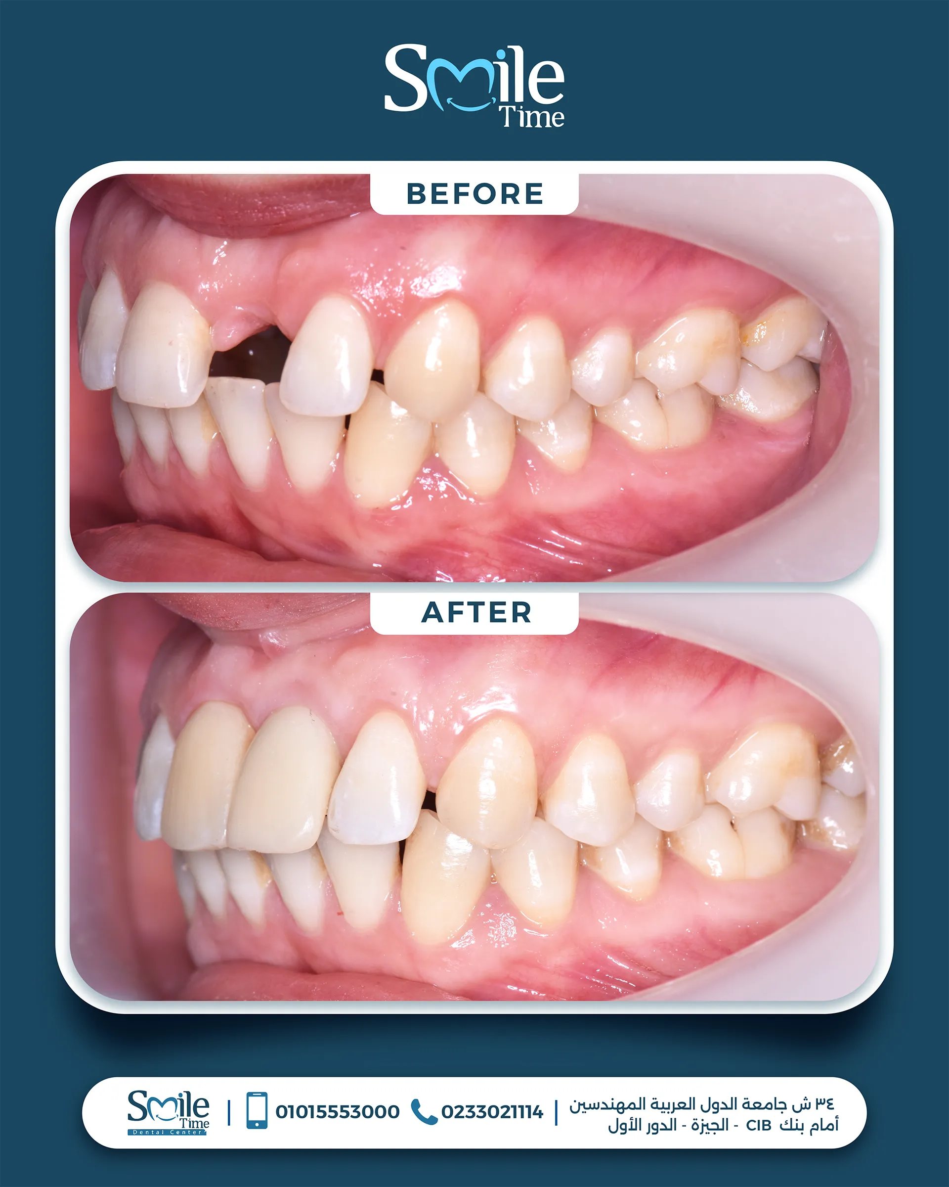 smile-time-before-and-after-5