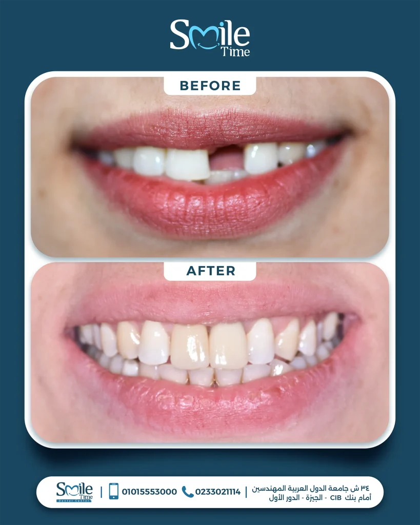 smile-time-before-and-after-6