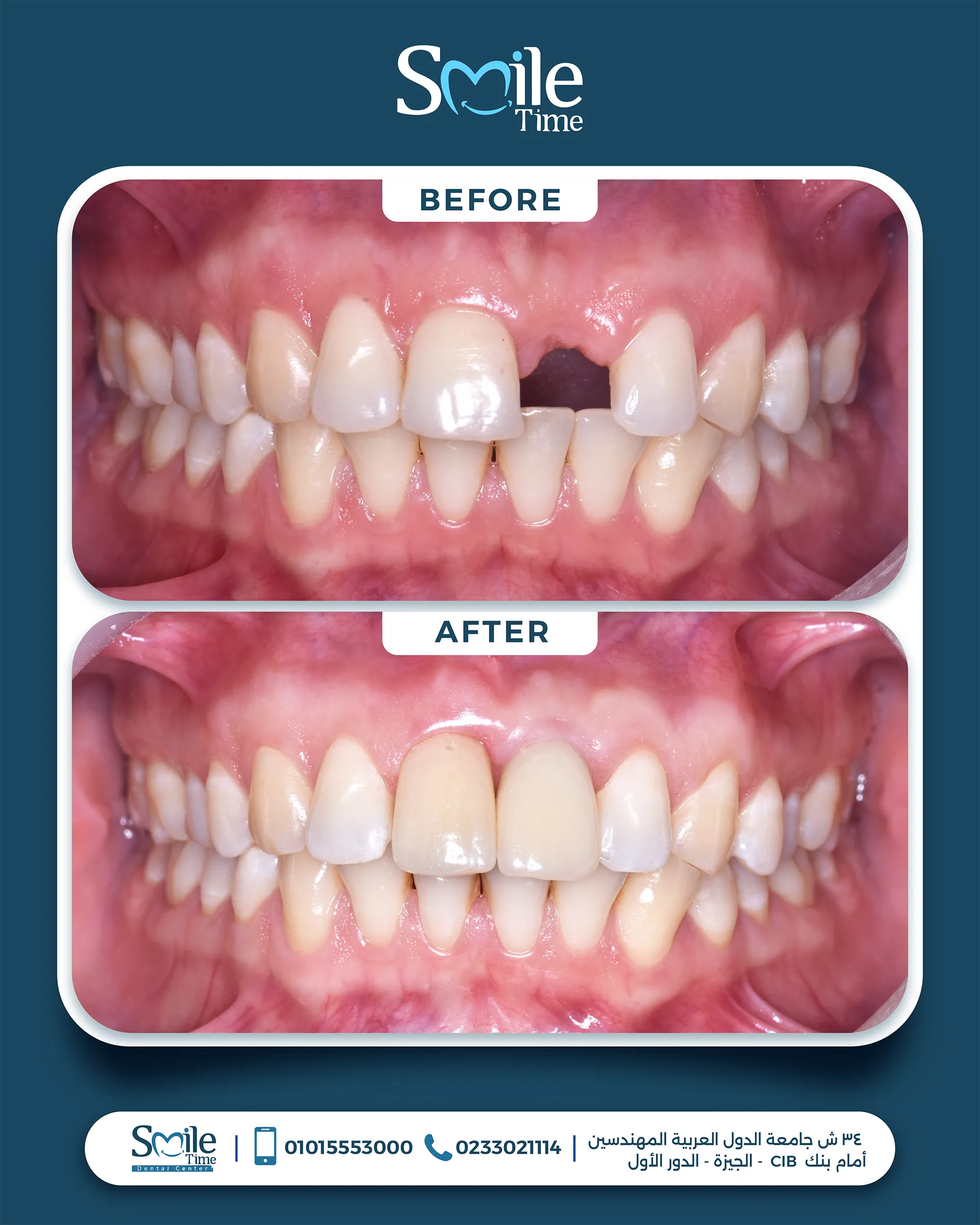 smile-time-before-and-after-7