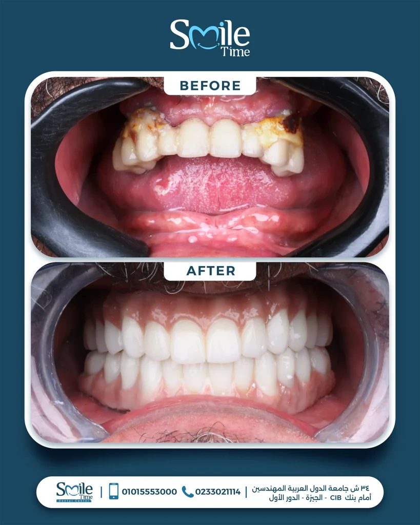 smile-time-before-and-after-8