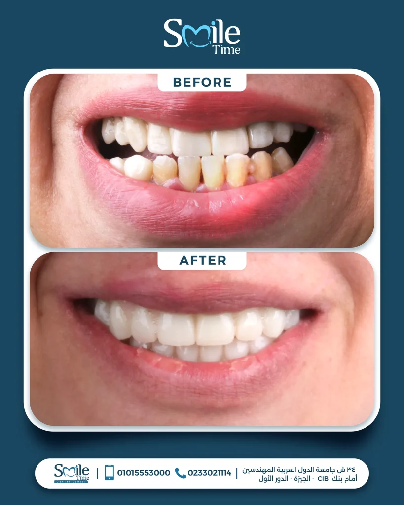 smile-time-before-and-after-9