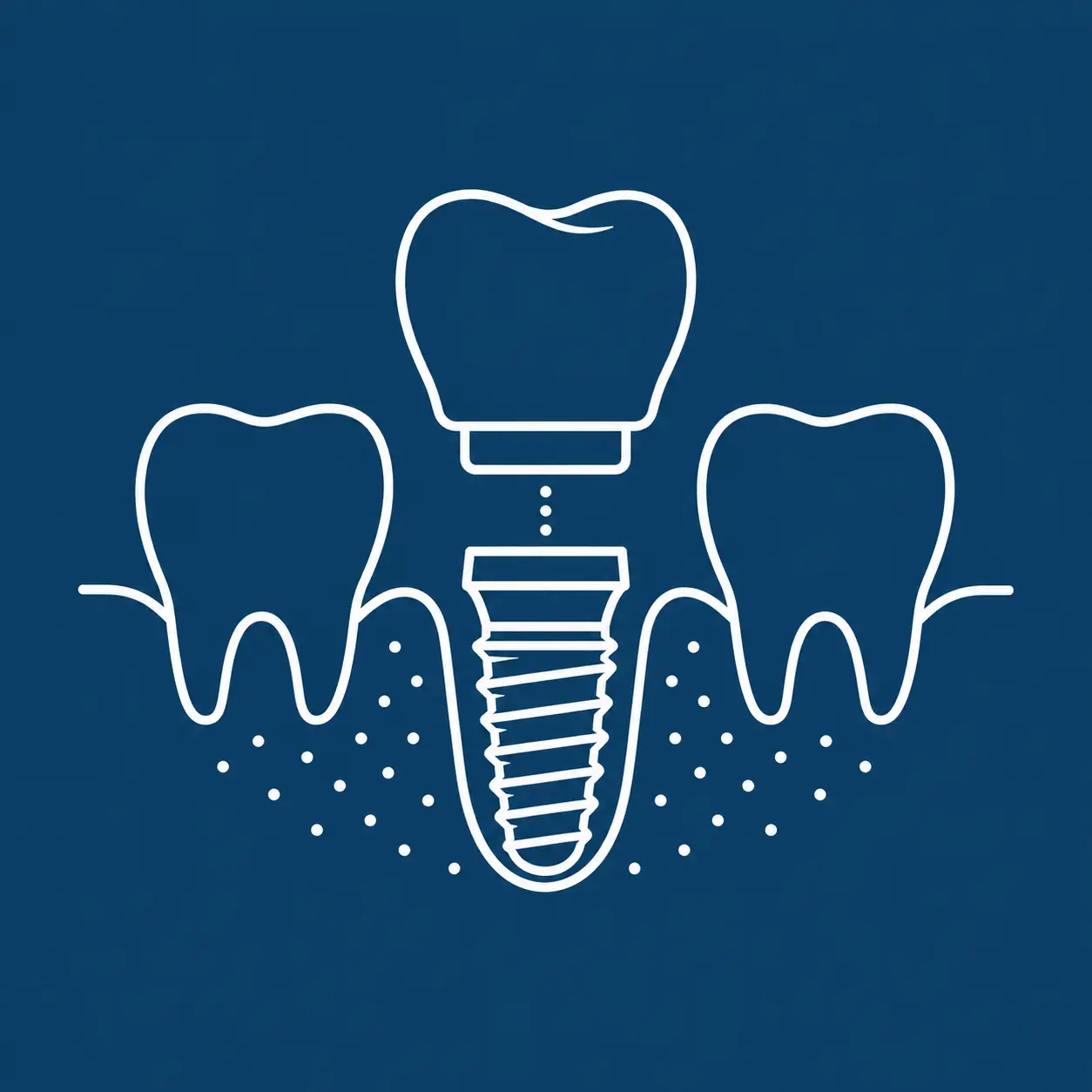 Immediate Implants icon