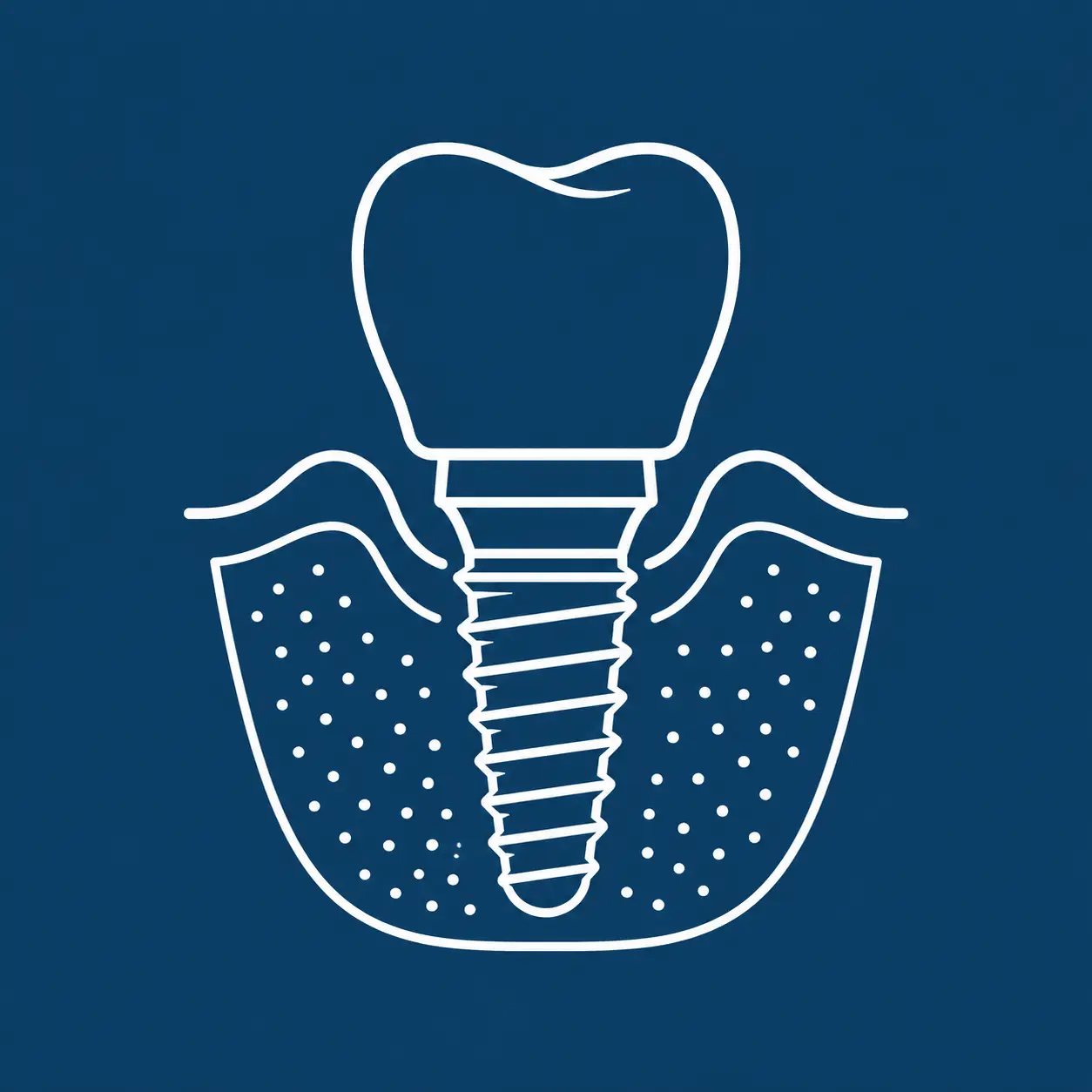 Traditional Implants​ icon